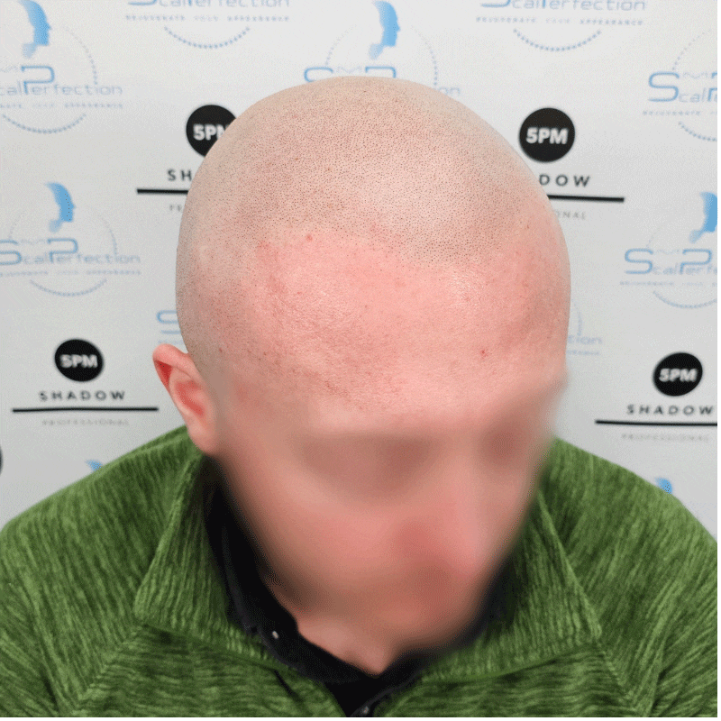 antonio-smp-client-great-yarmouth-after