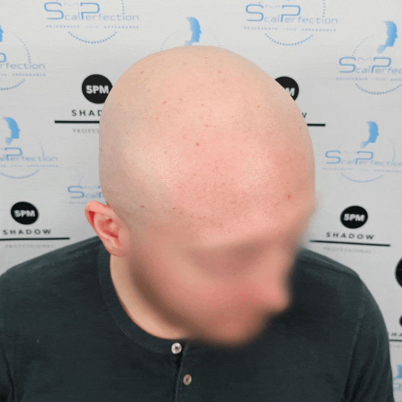 antonio-smp-client-great-yarmouth-before antonio-smp-client-great-yarmouth-before
