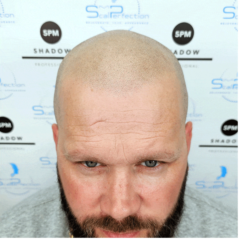 chris-smp-client-colchester-after