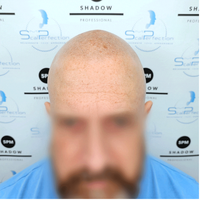 steven-smp-client-felixstowe-after