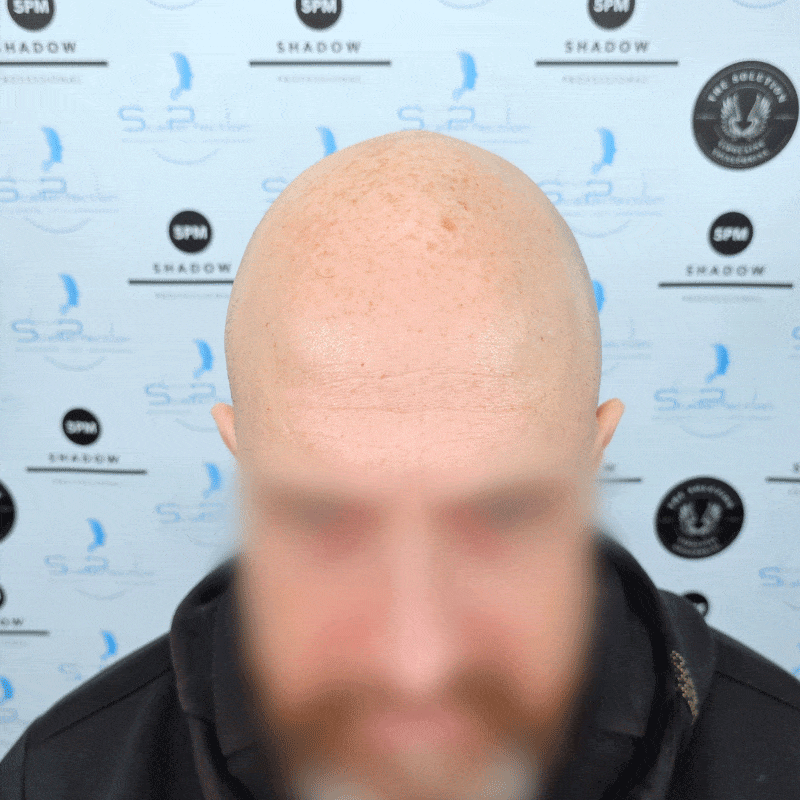 steven-smp-client-felixstowe-before