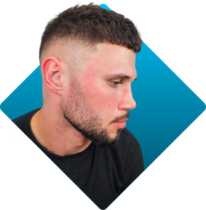 Beard Pigmentation After