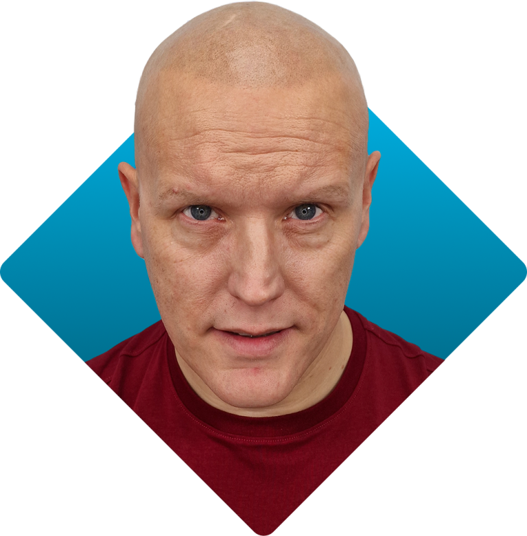 Solution - alopecia after 1