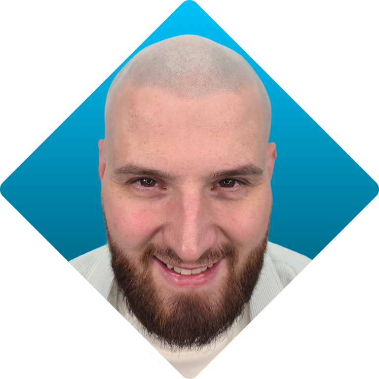 Solutions - thinning hair after